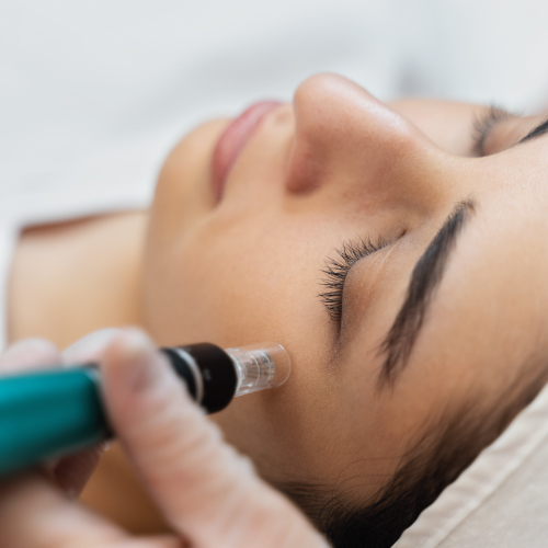 microneedling dental bridge