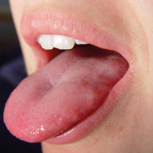 mouth-cancer-screening-menu