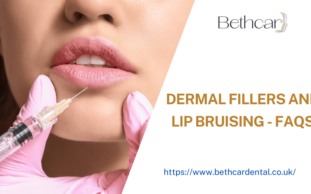 Dermal Fillers And Lip Bruising – FAQs
