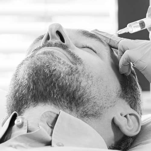 Sculptra composite-bonding-bw