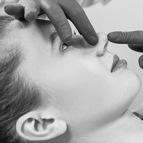 rhinoplasty composite-bonding-bw